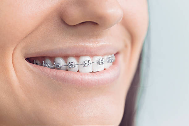 Best Full Mouth Reconstruction  in Bridgeport, WV